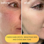Vit-C Brightening Oil | 15 ML