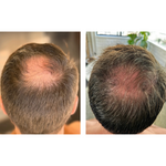 Hair Support Serum