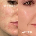 Vit-C Brightening Cleanser | 100 ML